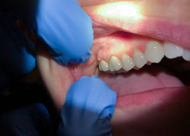 Best Emergency Root Canal Treatment in Arden Arde, CA